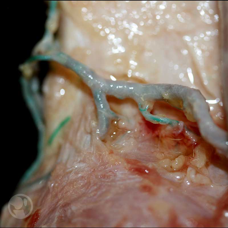 Arteria rodilla