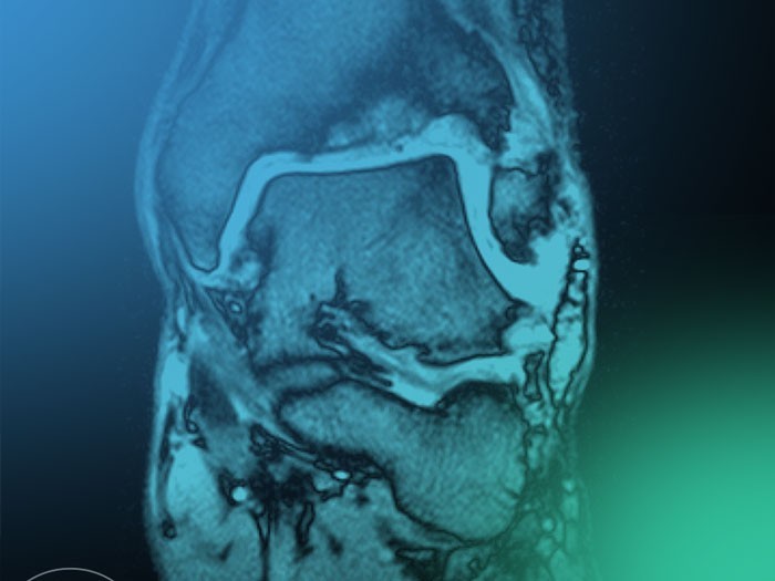 Actualiza tu Comprensión de la Anatomía y Biomecánica en las Osteotomías para Corregir la Artropatía de Tobillo