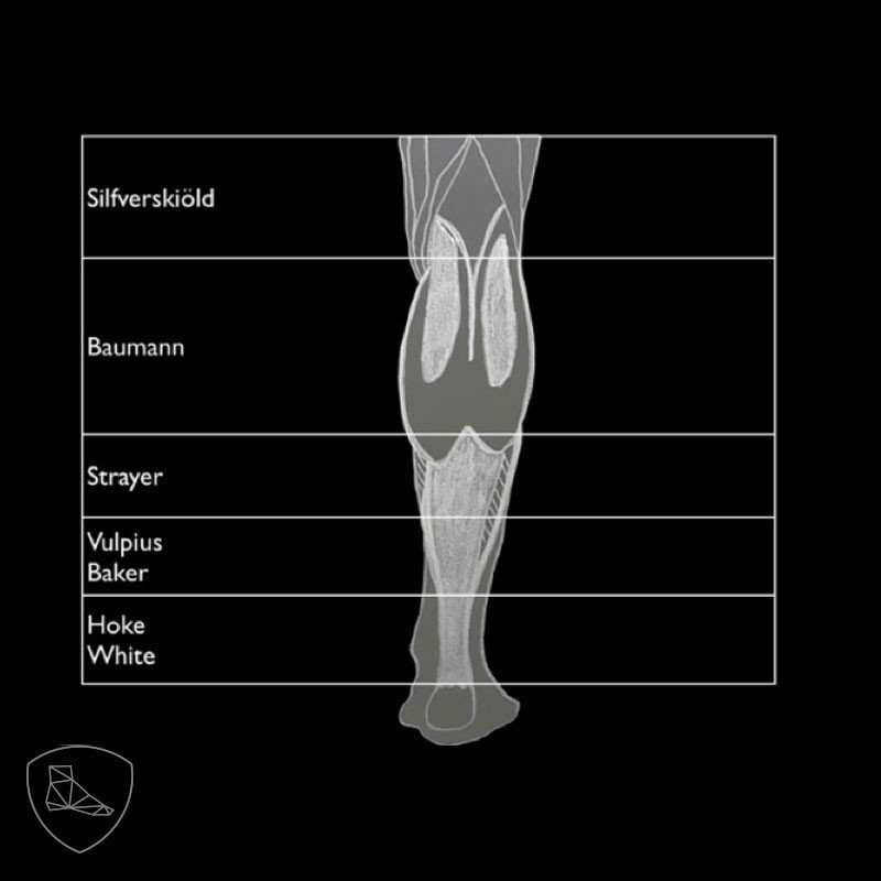 osteochondroza de gradul 1 al articulației umărului cum să tratezi artroza articulației încheieturii