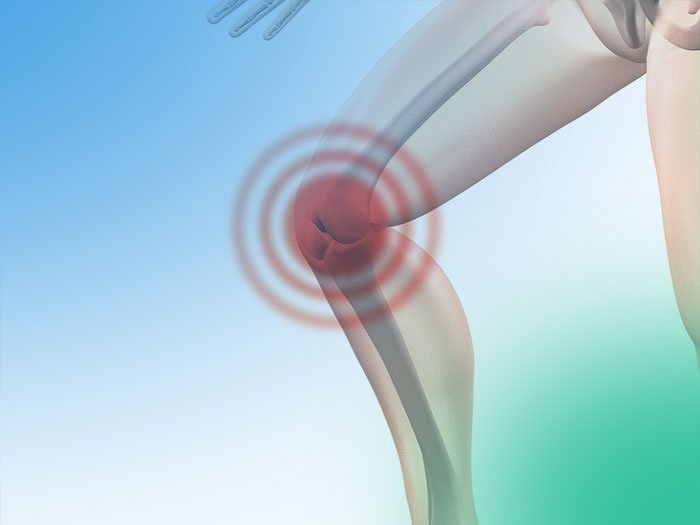 ¿Conoces los tipos de infecciones en la rodilla y sus vías de entrada?