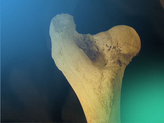Osteotomía femoral proximal varizante/desrotadora en niños y adolescentes.