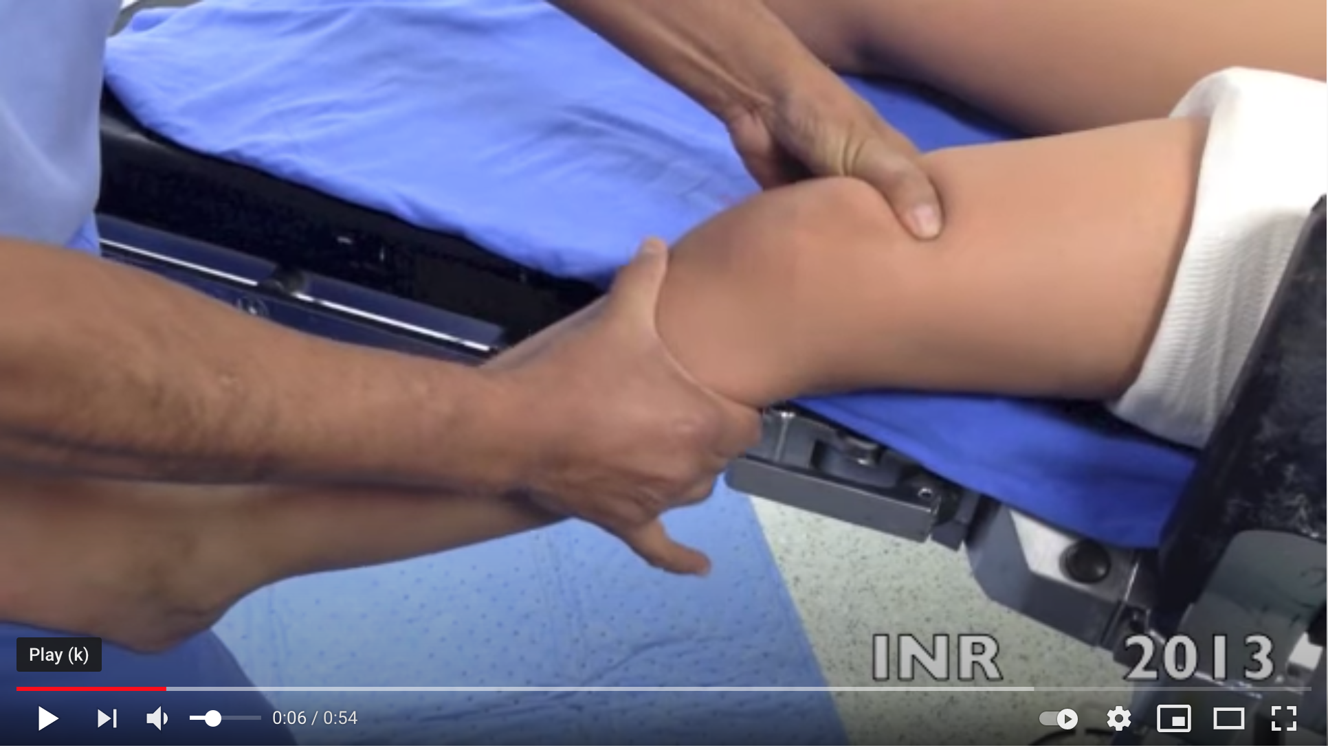 Exploracion fisica bajo anestesia de paciente con lesion de ligamento cruzado anterior y colatreal medial