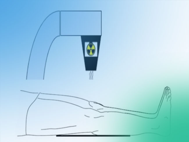 Imágenes y referencias radiológicas transoperatoria en cirugía de patela