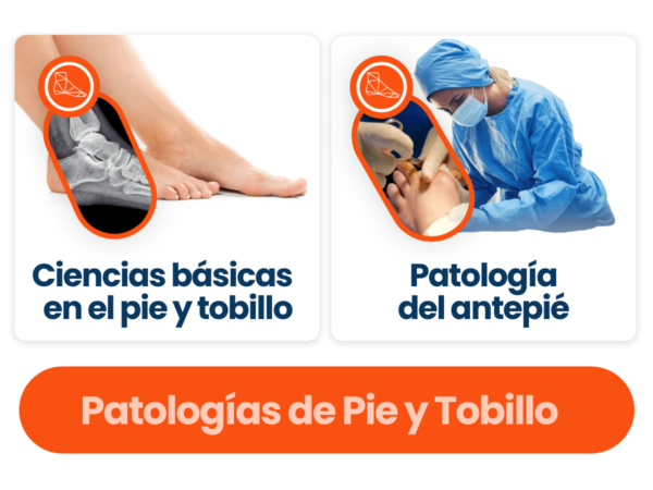 Patologías de Pie y Tobillo