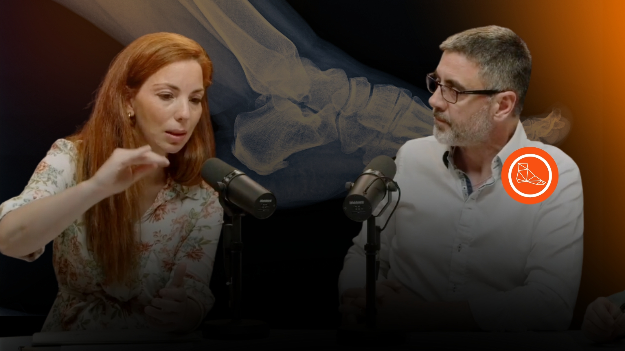 Osteotomías de Calcáneo por Cirugía MIS