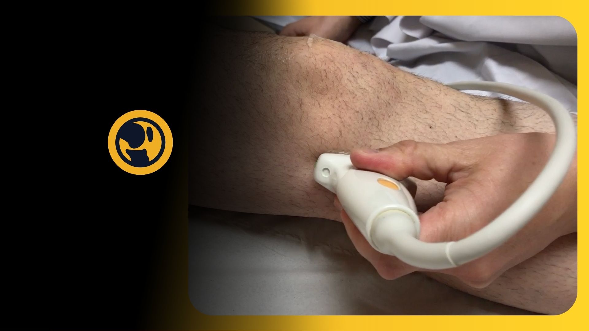 Ecografía de Rodilla: Técnicas de exploración física por ultrasonido