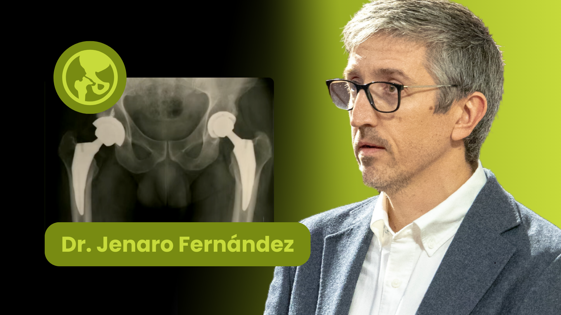 Artroplastia de Cadera Ambulatoria: perspectiva y experiencia práctica